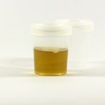 urine in a container