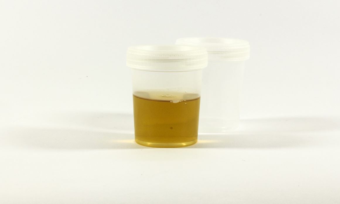 urine in a container